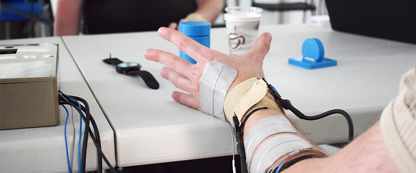 Advances in motor neuroprosthetics improve mobility in tetraplegics