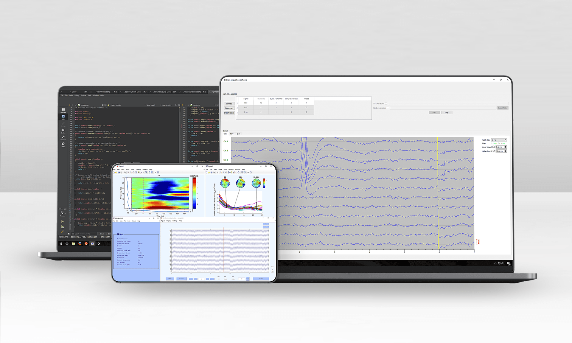 software for eeg monitoring and raw data visualization in real time