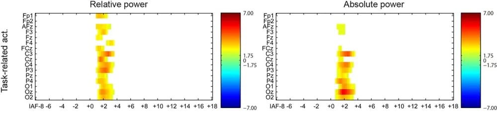 Adhd Eeg Results