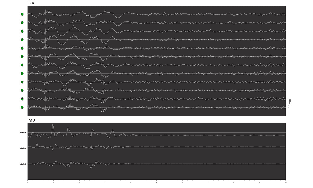 Eeg Signal and Imu