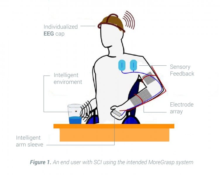 Figura De Un Hombre Con Tetraplejia Con El Sistema Bci No Invasivo Desarrollado Con Eeg Y Neuroprotesis Por Investigadores De Moregrasp
