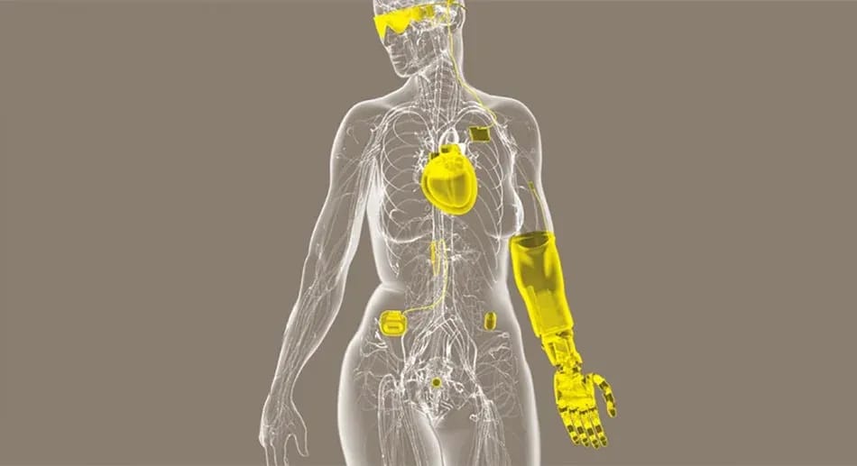 Implantes Tecnologicos Cuerpo Persona
