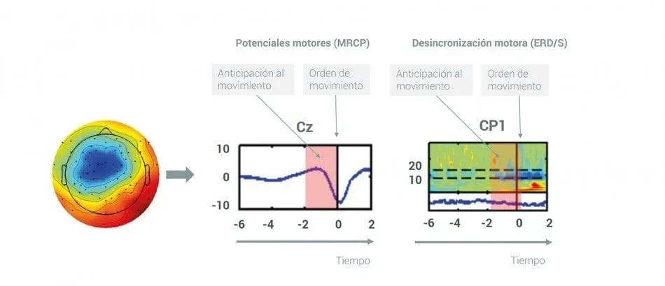 Infografia Potenciales Motores Desincronizacion Motora