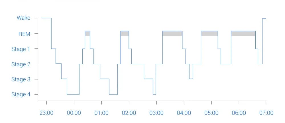 Sleep Eeg Graph 1