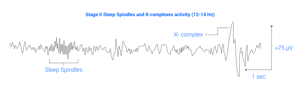 Sleep Eeg Graph 3